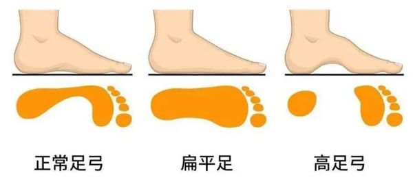 足部對比圖