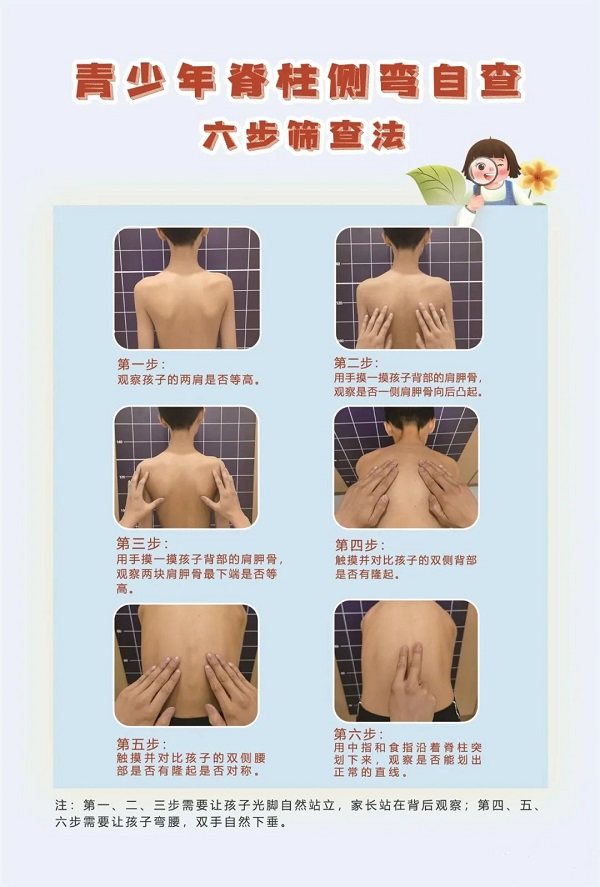 脊柱側(cè)彎六步篩查法