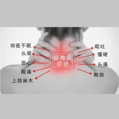 頸椎病癥狀