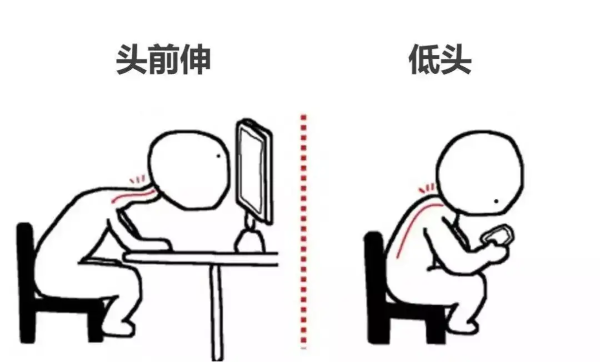 頸椎不良姿勢