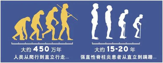 強直性脊柱炎