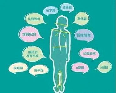 脊柱側(cè)彎危害