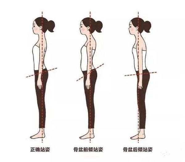 骨盆前傾后傾