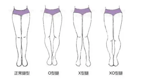 腿型