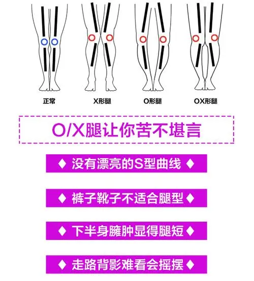 O/X腿型困擾