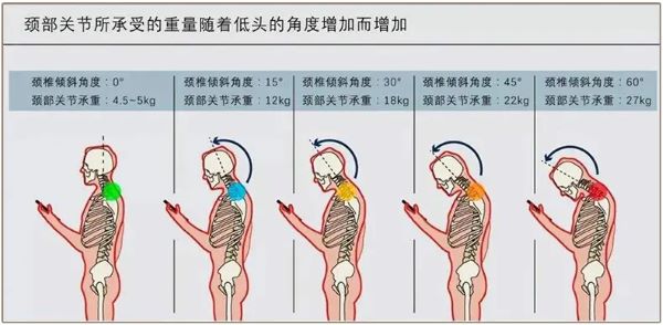 頸部關節承重