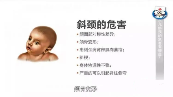 斜頸危害