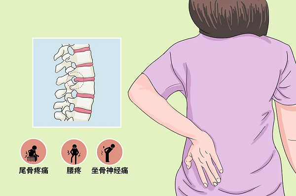 腰突癥狀